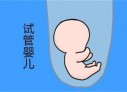 培养福州捐卵宝宝艺术细胞的小技巧